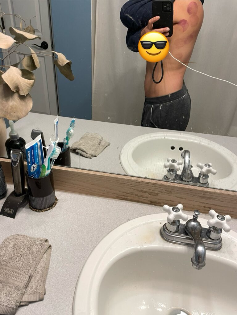 Cupping for back pain, how I cut my hair in layers at home, and the healthy meal my boys are obsessed with
