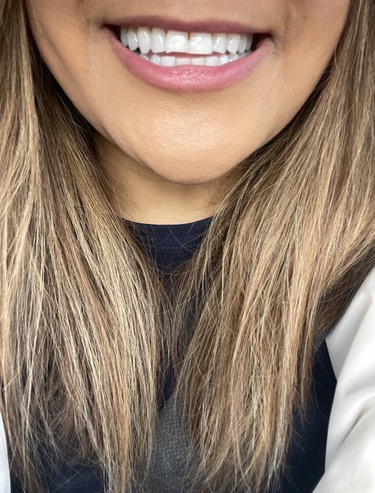 Life’s little dilemmas- what to use on a burn immediately, what my dentist recommends for teeth whitening, and the first book to read to your kids when they ask “Where do babies come from?”